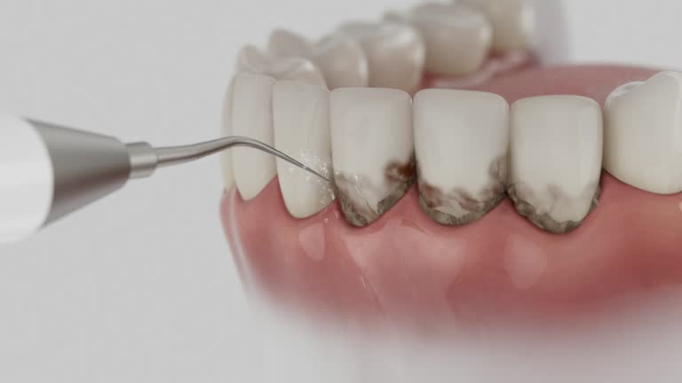 Reliable Emergency Dentist contractor in Jennings, MO by Smile Center Dentistry